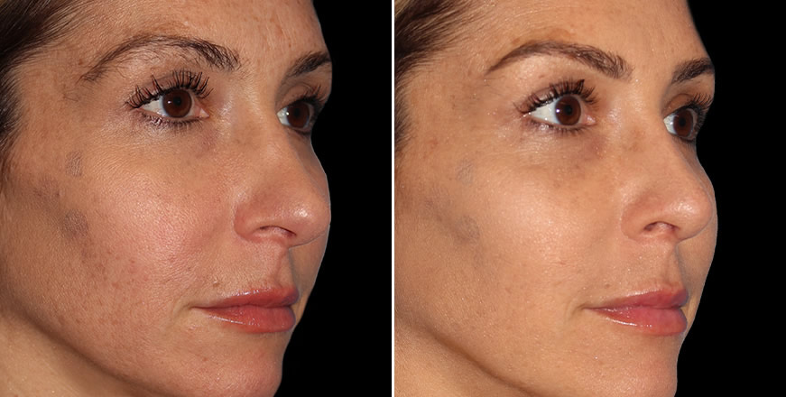 Plastic Surgery Results